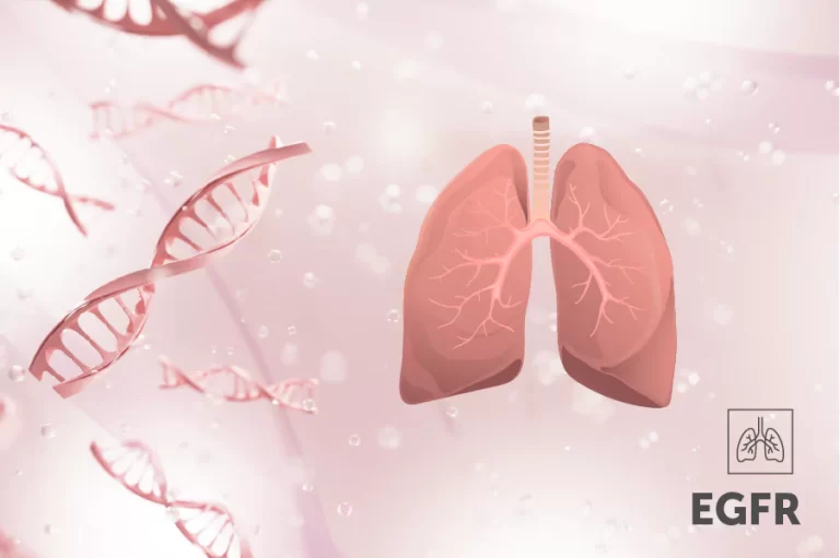 Detecția mutațiilor EGFR în cancerul pulmonar