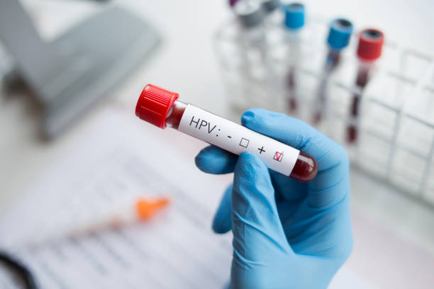 HPV: cea mai comună infecție transmisă pe cale sexuală la nivel global