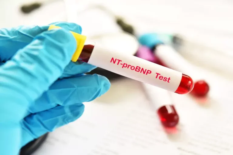 NT-proBNP și Insuficiența Cardiacă: Rol, interpretare și implicații clinic