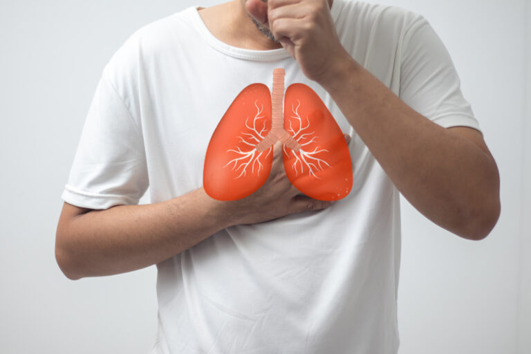 Tuberculoza – O boală infecțioasă cu impact global