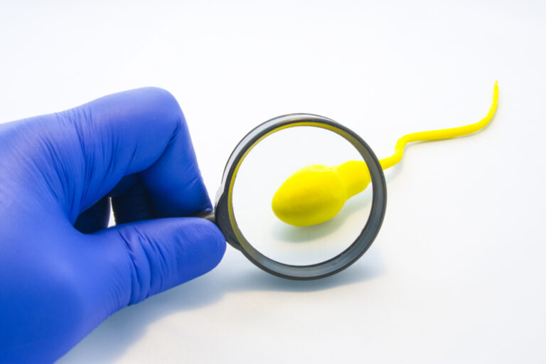 Determinare fragmentare ADN sperma/lichid seminal (Test Sperm Func)﻿