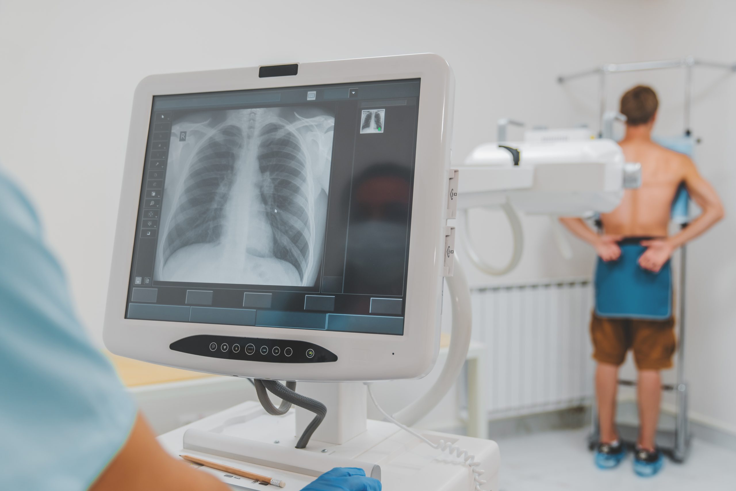 Radiografie Digitală